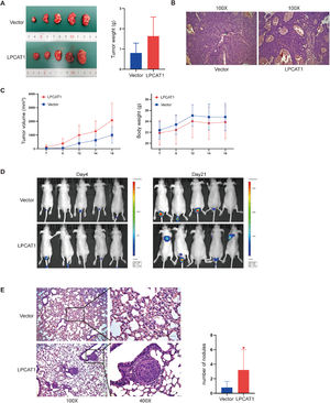 LPCAT1 overexpression accelerates HCC lung metastasis in vivo. (A) Macroscopic images of subcutaneous tumors derived from Huh7-vector cells and Huh7-LPCAT1 cells were obtained on postinjection day 16. The tumor weight of xenografts was quantified after excision. The total body weight of nude mice and the total tumor volume of the xenografts were measured every two days (n=5 for each group). (B) Representative H&E-stained sections of xenograft tumors. (100X magnification; scale bars: 100 µm) (C) Metastatic progression was recorded and quantified with IVIS each week after tail vein injection. Representative bioluminescent images of the metastatic tumors are shown. (n=5 for each group) (D) Representative H&E staining images and statistical analysis of pulmonary metastatic nodules in tumors. (100X and 400X magnification; scale bars: 100 μm) (n=5 for each group; *P<0.05 vs. vector group) Each experiment was repeated at least three times. Error bars represent the SD. Statistical data in tumor formation assays and lung metastatic nodules are described as the means±SD. (Abbreviations: H&E, hematoxylin-eosin; IVIS, in vivo imaging system; SD, standard deviation).