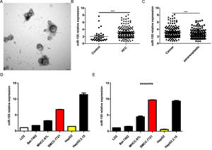 MiR-155 Is Highly Expressed in HCC Patient Serum-Derived Exosomes, Tumor Tissues, and HCC Cell lines. A Plasma exosome electron microscopy images; B Differences in relative expression of plasma exosome miR-155 in HCC compared with controls; C Differences in relative expression of miR-155 in cancer and paraneoplastic tissues; D Relative expression of microRNA-155 within each cell line and in exosomes.