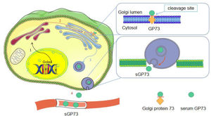 Synthesis and the actions of sGP73. 1: The coding gene directs the synthesis of Golgi protein; 2: GP73 presents on the Golgi apparatus; 3: Under diseased state, GP73 is cleaved. Vesicular transports sGP73 out of the cell; 4: sGP73 enters the serum.
