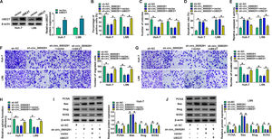 UBE2T overexpression largely offsets circ_0000291 knockdown-mediated anti-tumor effects in HCC cells. (A) Western blot assay was conducted to analyze the overexpression efficiency of UBE2T plasmid in HCC cells. (B-J) Huh-7 and LM6 cells were transfected with sh-circ_00002961 alone or together with UBE2T plasmid. (B and C) The proliferation capacity of transfected HCC cells was evaluated by EdU assay and colony formation assay. (D and E) The apoptosis of transfected HCC cells was assessed by flow cytometry and a commercial caspase 3 activity assay kit. (F and G) The migration and invasion abilities of transfected HCC cells were examined by transwell assays. (H) Sphere formation assay was performed to analyze the sphere formation efficiency of transfected HCC cells. (I and J) The protein expression of PCNA, Bax, Slug, and SOX2 in transfected HCC cells was examined by western blot assay. *P<0.05.