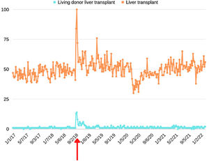 Google Trends searches for “liver transplant” and “living donor liver transplant” from 2017-2022