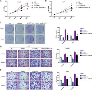 MiR-3682 promoted biological behaviors of HCC cells by targeting ADRA1A. (A, B) The proliferation of HepG2 (A) and Huh7 (B) cells transfected with si-ADRA1A and/or miR-3682 inhibitor/NC was measured by CCK-8 assays. (C) Colony formation assay of HCC cells transfected with si-ADRA1A and/or miR-3682 inhibitor/NC. (D, E) The migration and invasion of HepG2 (D) and Huh7 (E) cells transfected with si-ADRA1A and/or miR-3682 inhibitor/NC was measured by transwell assays, magnification  × 200. The data are exhibited as mean±SD with triplicates. ⁎⁎P < 0.01 vs. inhibitor NC group. ##P < 0.01 vs. inhibitor group