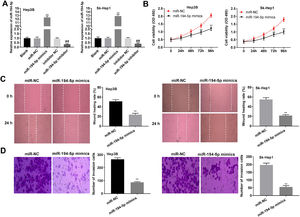 Overexpression of miR-194-5p repressed cell viability, migration and invasion in hepatocellular carcinoma (HCC) cells. (A) Relative expression of miR-194-5p in Hep3B and Sk-Hep1 cells was detected by quantitative real-time polymerase chain reaction (qRT-PCR). ⁎⁎P < 0.01, vs. miR-NC. ##P < 0.01, vs. inhibitor NC. (B) Cell viability in Hep3B and Sk-Hep1 cells was determined by 3-(4, 5-Dimethyl-2-Thiazolyl)-2, 5-Diphenyl-2-H-Tetrazolium Bromide (MTT) assay. ⁎⁎P < 0.01, vs. miR-negative control (NC). (C) Wound healing rate of Hep3B and Sk-Hep1 cells was determined by wound healing assay. ⁎⁎P < 0.01, vs. miR-NC. (D) Number of invasion cells in Hep3B and Sk-Hep1 cells was detected by transwell assay. ⁎⁎P < 0.01, vs. miR-NC.