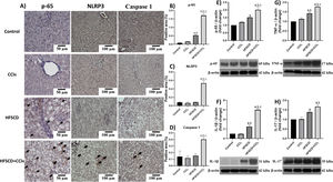 Level of NF-κB (p65), proinflammatory cytokines, and NLRP3 in livers from the HFSCD and HFSCD+CCl4 groups. A) Representative IHC images of p65, NLRP3, and caspase 1 in livers from the control, CCl4, HFSCD, and HFSCD+CCl4 groups. Scale bar = 50 μm and 100 μm. The percentages of the positive label for p65 (B), NLRP3 (C), and caspase 1 (D) were obtained from IHC slices (n = 4). The positivity label is indicated by arrows. Levels of p65 (E), interleukin (IL)-1β (F), TNF-α (G), and IL-17 (H) proteins were detected by western blot (n =3). β-Actin was used as the loading control. Values are presented as the fold change of optical density normalized to values of the control group (control = 1). Bars represent the mean ± SEM. (a) P < 0.05 compared with the control group; (b) P < 0.05 compared with the CCl4 group; (c) P < 0.05 compared with the HFSCD group. NF-κB: nuclear factor kappa B, NLRP3: nucleotide-binding domain leucine-rich-containing family, pyrin domain-containing-3, IHC: immunohistochemistry, HFSCD: high-fat, sucrose, and cholesterol diet, CCl4: carbon tetrachloride, TNF-α: tumor necrosis factor-alpha, SEM: standard error of the mean.