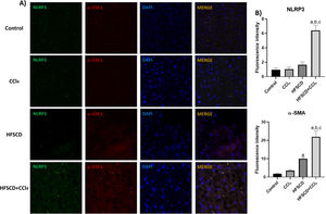 Double labeling of NLRP3 and α-SMA in livers from the HFSCD and HFSCD+CCl4 groups. A) IF labeling of NLRP3/α-SMA in livers from the control, CCl4, HFSCD, and HFSCD+CCl4 groups. B) Fluorescence intensity of NLRP3 and α-SMA was quantified from IF slices (n = 3). Bars represent the mean ± SEM. (a) P < 0.05 compared with the control group; (b) P < 0.05 compared with the CCl4 group; (c) P < 0.05 compared with the HFSCD group. NLRP3: nucleotide-binding domain leucine-rich-containing family, α-SMA: smooth muscle alpha-actin, HFSCD: high-fat, sucrose, and cholesterol diet, CCl4: carbon tetrachloride, IF: immunofluorescence, SEM: standard error of the mean.