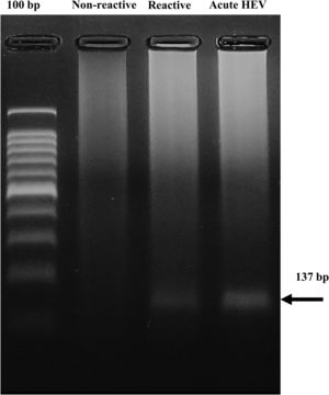 Detection of HEV RNA in serum from blood donors reactive to anti-HEV antibodies. The 137 bp product found in one pool of six seropositive samples (Reactive) and in the sample from a confirmed HEV patient (acute HEV) is shown. Data from a representative pool of randomly selected seronegative samples for anti-HEV antibodies (not reactive) are shown.