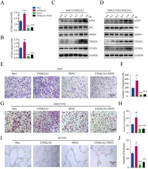 Activation of the NF-κB pathway by CSNK2A2, along with the upregulation of genes involved in HCC migration, proliferation and endothelial tube formation. A. CCND1, MMP9, VEGF, p65 and p-p65 expression in Huh7 cells which had been transformed using lentiviruses that expressed shCSNK2A2 or shControl. Expression levels were determined by western blotting, with β-actin used as the control. B. CCND1, MMP9, VEGF, p65 and p-p65 expression in MHCC97H cells which had been transformed using lentiviruses that expressed shCSNK2A2 or shControl. Expression levels were determined by western blotting, with β-actin used as the control. C. CCK8 was used for testing Huh7 cell proliferation after infection with shCSNK2A2 and subsequent treatment with 20 μM of PDTC (***P<0.001, Student's t-test). D. CCK8 was used for testing MHCC97H cell proliferation after infection with shCSNK2A2 and subsequent treatment with 20 μM of PDTC (**P<0.01, ***P<0.001, Student's t-test). E-F. Migration results for Huh7 cells infected with shCSNK2A2 before treatment with 20 μM of PDTC (**P<0.01, Student's t-test). G-H. Migration results for MHCC97H cells infected with shCSNK2A2 before treatment with 20 μM of PDTC (**P<0.01, Student's t-test). I-J. Results of endothelial tube formation for HUVEC cells infected with shCSNK2A2 before treatment with 20 μM of PDTC (*P<0.05, ***P<0.001, Student's t-test).