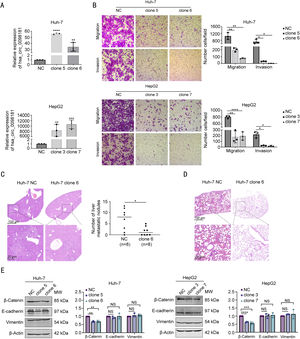 Hsa_circ_0098181 impedes HCC metastasis in vitro and in vivo. (A) The expression levels of hsa_circ_0098181 in Huh-7 and HepG2 cells after overexpressing hsa_circ_0098181 were detected by qRT-PCR. (B) The migratory and invasive capacities of Huh-7 and HepG2 cells after overexpressing hsa_circ_0098181 were evaluated by Transwell migration and invasion assays, respectively. (C) (Left) Representative images of hematoxylin-eosin staining of liver tissues from nude mice. Scale bar, 100 μm in the upper panel; 20 μm in the lower panel. (Right) The number of metastatic liver nodules in nude mice was compared between the two groups. (D) Representative images of hematoxylin-eosin staining of lung tissues from nude mice. Scale bar, 100 μm in the upper panel; 20 μm in the lower panel. (E) The expression levels of EMT-related proteins β-catenin, E-cadherin and Vimentin after overexpressing hsa_circ_0098181 were determined by western blot analysis. β-Actin was used as an internal control. Data were shown as mean ± standard deviation of three independent experiments. *P<0.05, ⁎⁎P<0.01, ⁎⁎⁎P<0.001, ⁎⁎⁎⁎P<0.0001; NS, no significance.