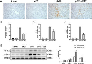 MET decreased expression of α-SMA and HIF-1α: (A) expression levels of α-SMA in the liver tissues detected by immunohistochemistry (200× magnification, scale = 50μm); (B) proportion of positive area of α-SMA; (C-D) mRNA expression levels of HIF-1α and α-SMA detected by qPCR; (E) protein expressions of HIF-1α and α-SMA detected by western blot. n = 10/group. #p < 0.05, vs. pIVCL; * p < 0.01, vs. pIVCL. MET, metformin; pIVCL, partial ligation of the inferior vena cava; α-SMA, α-smooth muscle actin; HIF-1α, hypoxia-inducible factor-1α.