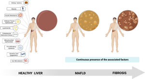The multiple hits theory. The multiple hits theory highlights the diverse factors associated with metabolic-associated fatty liver disease (MAFLD) and their interaction in the development and progression of the disease. Such factors extend from the dietary habits of individuals to the activation of complex signaling pathways. Providing an overview of the complex pathophysiology of MAFLD (Created with BioRender).
