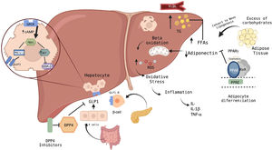 Pathways of action of hypoglycemic agents in the liver and their relationship with the pathophysiology of MASLD.