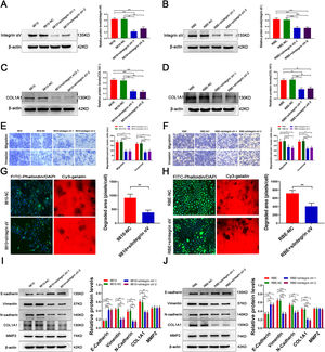 MMP2 regulates COL1A1 via the integrin alpha Ⅴ pathway and affects ECM remodelling. (A) Integrin αV protein expression levels were determined by western blotting analysis after transfection of HCCC-9810 cell lines with integrin αV-siRNA. (B) Integrin αV protein expression levels were determined by western blotting analysis after transfection of RBE cell lines with Integrin αV-siRNA. (C) COL1A1 protein expression levels were determined as in (A). (D) COL1A1 protein expression levels were determined as in (B). (E) Transwell migration and invasion assays of HCCC-9810 parental, NC and HCCC-9810 cells with Integrin αV-siRNA incubation for 12 h and 36 h. (F) RBE cells as in (E) were incubated for 12 h and 24 h. (G) ECM degradation analysis of control HCCC-9810-NC and HCCC-9810 cells with Integrin αV-siRNA ware plated on Cy3 gelatine matrices for 36 h. The degradation under the cells was quantified as described in the Materials and Methods, and the area per cell was plotted (right). (H) RBE cells as in (G) ware plated on Cy3 gelatine matrices for 24 h. The degradation was described as in (G). (I) E-cadherin, vimentin, N-cadherin, MMP2 and COL1A1 protein expression levels were determined by western blotting in control HCCC-9810 parental, NC and HCCC-9810 cells with Integrin αV-siRNA incubation for 36 h. (J) RBE cells as in (I) were incubated for 24 h. *P<0.05; **P<0.01 and ***P<0.001. Experiments were repeated at least three times independently. 9810, HCCC-9810; OE, overexpression; KD, knockdown; NC, negative control.