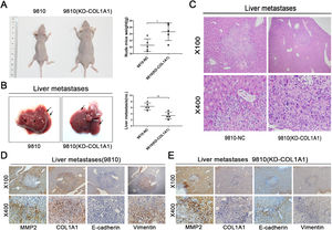 COL1A1 contributes to the invasion and metastasis of CCA in vivo. (A) Nude mice were injected with tumour cells through the spleen. (n = 5 per group). The weights of the mice were counted (right). (B) Representative photographs of liver metastasis foci in mice 45 days after splenic injection of HCCC-9810 cells with or without COL1A1 knockdown (n=5 per group). Quantification of the number of liver metastatic foci is shown on the right. (C) Representative images of metastatic foci (magnification, x100 and x400) in haematoxylin and eosin-stained liver tissue sections from mice injected with control or COL1A1 knockdown HCCC-9810 cells. (D) Paraffin-embedded liver metastasis nodules were stained with anti-MMP2, anti-COL1A1, anti-E-cadherin or anti-Vimentin antibodies using CCA. (E) Paraffin-embedded liver metastasis nodules (HCCC-9810(KD-COL1A1)) were stained with anti-MMP2, anti-COL1A1, anti-E-cadherin or anti-Vimentin antibodies using CCA. *P<0.05 and **P<0.01. Experiments were repeated at least three times independently. 9810, HCCC-9810; KD, knockdown; NC, negative control.