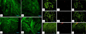Cell viability. Fibroblast growth after 10 days. Figures A, B, C, D, E, G, and I alive/dead test positive for calcein. Figures E´, G´, I´, positive for ethidium homodimer. Figures F, H, and J MERGE.
