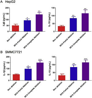 Serum levels of interleukin (IL)-1β and IL-18 with radiofrequency ablation (RFA) in xenograft mouse models. The serum levels of IL-1β and IL-18 were examined by enzyme-linked immunosorbent assays (ELISAs) in (A) HepG2 cell-derived xenograft nude mice and (B) SMMC-7721 cell-derived xenograft nude mice after 4 weeks of RFA partial ablation, RFA complete ablation, or no ablation. Data are presented as the mean ± SD. *P < 0.05; **P < 0.01; ***P < 0.001.