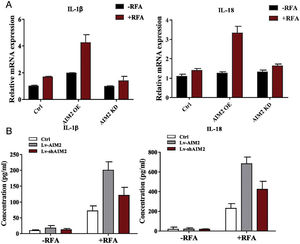Effects of AIM2 knockdown or overexpression on pro-inflammatory cytokine production by SMMC-7721 cells. AIM2 was overexpressed in SMMC-7721 cells using an expression vector (OS-AIM2). AIM2 was knocked down in SMMC-7721 cells using short hairpin RNAs (shRNAs). (A) qRT-PCR analysis was conducted to measure the mRNA expression levels of interleukin (IL)-1β and IL-18. (B) Enzyme-linked immunosorbent assays (ELISAs) were performed to determine the IL-1β and IL-18 levels in the cell culture supernatant of SMMC-7721 cells. P < 0.05 indicated a significant difference between groups.