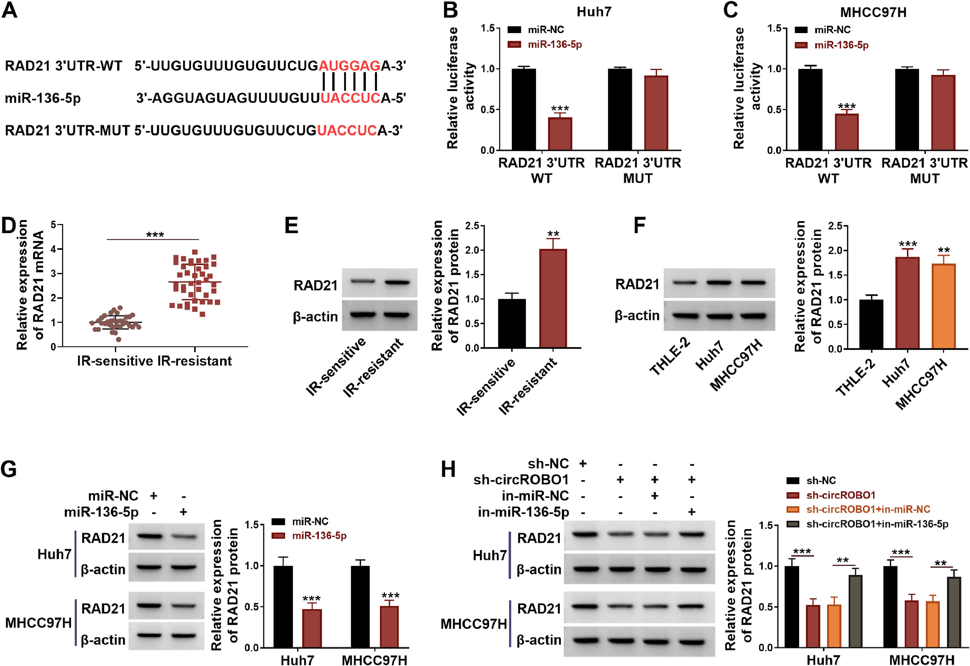 Non Functional Rad21 CircROBO1 knockdown improves the radiosensitivity of hepatocellular ...