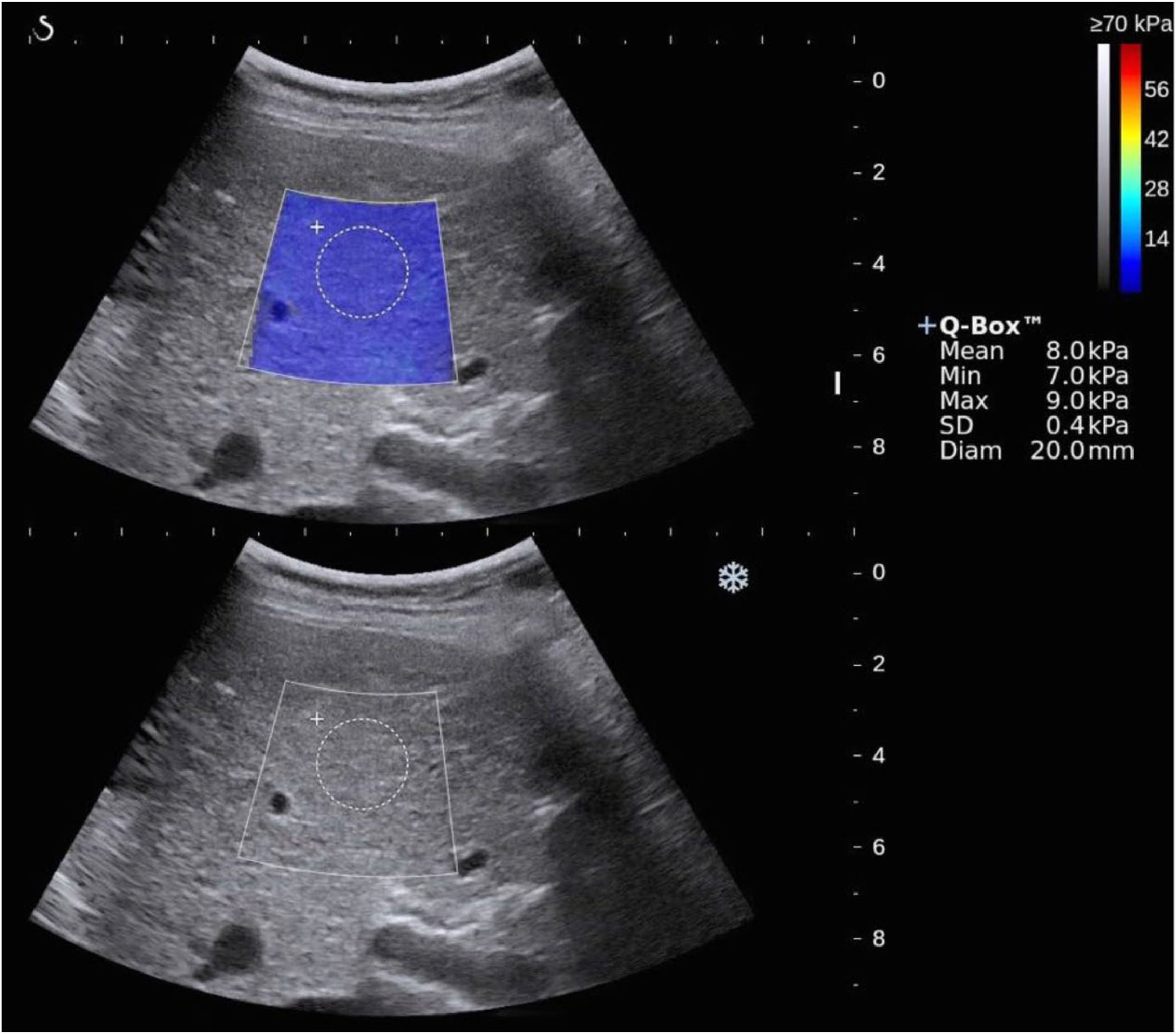 fig0002