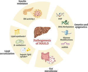 Various factors play integral roles in the pathogenesis of MASLD. Differential changes in multiple areas (including insulin resistance, genetics and epigenetics, gut microbiome, and lipid accumulation) have a profound impact on the pathogenesis of MASLD. (Created with BioRender.com). DNA, deoxyribonucleic acid; IRS, insulin receptor substrate; miRNA, microRNA; SNP, single nucleotide polymorphism.