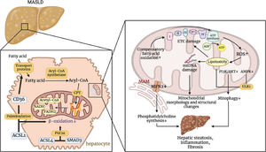 Pathophysiological mechanisms by which Mitochondrial Dysfunction Affects MASLD. CD36 regulates transport proteins that transport fatty acids into cells. CD36 can promote the transport of long-chain fatty acids into the cell via transport proteins, and palmitoylated CD36 interacts with ACSL1 to inhibit β-oxidation. ACSL4 can also regulate PGC1α in a smad3-dependent manner to affect β-oxidation. These processes result in the accumulation of fatty acids within the hepatocyte. Impaired ETC and increased ROS production lead to lipotoxicity, which in turn damages mtDNA and exacerbates changes in mitochondrial structure and function. The accumulation of lipotoxicity and the inhibition of the PI3K/AKT and AMPK pathways impair mitochondrial autophagy. In addition, decreased MFN2 expression in MAMs leads to reduced phosphatidylcholine synthesis. This series of events ultimately promotes hepatic steatosis, inflammation, and fibrosis. (Created with BioRender.com). ACSL1, acyl-CoA synthetase long-chain family member 1; ACSL4, acyl-CoA synthetase long-chain family member 4; ADP, adenosine diphosphate; AMPK, AMP-activated protein kinase; ATP, adenosine triphosphate; ATP synthase, adenosine triphosphate synthase; CD36, cluster of differentiation 36; CPT, carnitine palmitoyltransferase; ETC damage, electron transport chain damage; FADH, flavin adenine dinucleotide (Reduced Form); MASLD, metabolic dysfunction-associated steatotic liver disease; MAM, mitochondria-associated membranes; MFN2, mitofusin 2; mtDNA, mitochondrial DNA; NADH, nicotinamide adenine dinucleotide (Reduced Form); PI3K/AKT, phosphoinositide 3-kinase / protein kinase B pathway; ROS, reactive oxygen species; SMAD3, SMAD family member 3; ULK1, unc-51 like autophagy activating kinase 1.