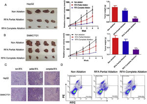 Inhibitory effects of radiofrequency ablation (RFA) on tumor growth in subcutaneous xenograft nude mice. HepG2 and SMMC-7721 cell-derived xenograft nude mice were used to examine the effects of RFA on tumor growth. The mean tumor sizes and weights were analyzed in the following three groups: No ablation as a control (Non-ablation), RFA partial ablation, and RFA complete ablation. (A) HepG2 cell-derived xenograft nude mice. Tumor growth was significantly suppressed four weeks after RFA partial or complete ablation, as indicated by the smaller tumor size and lower tumor weight compared with the no-RFA treatment control mice. (B) SMMC-7721 cell-derived xenograft nude mice. Tumor growth was significantly suppressed four weeks after RFA complete ablation, as indicated by the smaller tumor size and lower tumor weight compared with the no-RFA treatment control mice. (C) Histological findings of tumor sections from HepG2 and SMMC-7721 cell-derived xenograft nude mice. Hematoxylin and eosin staining of the tumor sections revealed a significant reduction in the number of tumor cells in the HepG2 and SMMC-7721 cell-derived xenograft nude mice treated with complete or partial RFA ablation compared with the control mice. (D) Flow cytometry analysis of pyroptotic cells in subcutaneous xenograft nude mice treated with complete or partial RFA ablation in comparison with the control mice. Data are presented as the mean ± SD. *P < 0.05; ***P < 0.001.