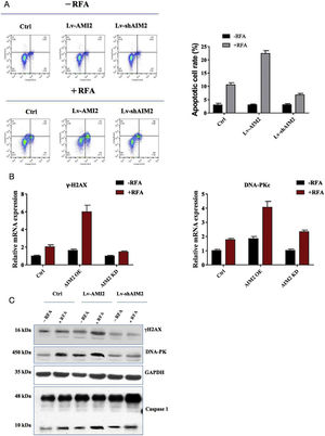 Effects of AIM2 knockdown or overexpression on radiofrequency ablation (RFA)-induced pyroptosis in SMMC-7721 cells. (A) Effects of AIM2 overexpression or knockdown on RFA-induced pyroptosis. Pyroptosis was determined by flow cytometry. Overexpression of AIM2 with an expression vector (OS-AIM2) induced the pyroptosis of SMMC-7721 cells compared with the negative control (NC). By contrast, knockdown of AIM2 with an AIM2-specific short hairpin RNA (shRNA) (shAIM) inhibited the pyroptosis of SMMC-7721 cells compared with the scrambled shRNA control. (B) The effects of AIM2 overexpression or knockdown on the mRNA levels of pyroptosis-related molecules before and after RFA were examined in SMMC-7721 cells using qRT-PCR assays. (C) Western blot analysis of the effects of AIM2 overexpression or knockdown on the protein levels of pyroptosis-related molecules before and after RFA in SMMC-7721 cells. P < 0.05 indicated a significant difference between groups.