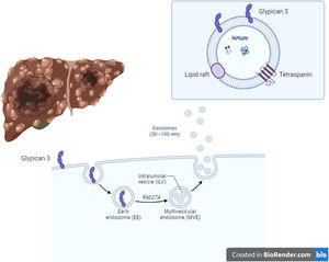 Hepatocellular carcinoma (HCC) development in liver cirrhosis is associated with impaired autophagy, thus inducing an increase of an HCC-specific biomarker called glypican-3 (GPC3). GPC3 is preferentially released through exosomes. The rate of GPC3-positive exosomes was higher in patients with HCC compared to exosomes isolated from non-cirrhotic and healthy controls. Therefore, GPC3+ exosomes could be promising biomarkers of HCC development. Created in BioRender.com.