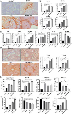 Ethanol and thioacetamide (EtOH+TAA) combination results in aggravated alcoholic liver disease. A: The hepatic expression of α-SMA (alpha-smooth muscle actin) measured by immunohistochemistry showed elevated expression in the ethanol+TAA group. B: The hepatic mRNA expression levels of fibrosis markers (Col-1α1, collagen, type 1, alpha1 and TGF-β, transforming growth factor-ß1) measured by qPCR (real-time polymerase chain reaction) showed elevated expression in the ethanol+TAA group. C: Hepatic mRNA expression of inflammatory (IL-6, interleukin 6; TNF-α, tumor necrosis factor-alpha; IL-10, interleukin-10 and mRNA and protein expression IL-1Ra, interleukin-1 receptor antagonist) and proliferation marker PCNA (proliferating cell nuclear antigen) showed elevated expression in ethanol+TAA group. D: Immunohistochemistry staining of F4/80 showed the highest expression in the ethanol+TAA group. Macrophage markers, C-C motif chemokine receptor 2 (Ccr2) was also highly expressed in the ethanol+TAA group. E: Liver triglycerides were significantly increased in ethanol+TAA. The mRNA expression of lipid metabolism markers: sterol regulatory element-binding protein 1c (Srebp-1c) and a cluster of differentiation-36 (CD36) were increased, while peroxisome proliferator-activated receptors gamma (PPAR-y) were decreased in ethanol+TAA group. F. Liver oxidative stress markers: Malondialdehyde (MDA) protein showed increased expression, while reduced glutathione (GSH) and superoxide dismutase (SOD) proteins showed decreased expression in ethanol+TAA. Protein expression of heme oxygenase (HO-1, induced by oxidative stress) showed increased expression in the ethanol+TAA group. Values are expressed as means ± SEM. *p < 0.05, **p < 0.01, ***p < 0.001.