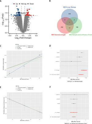 Analysis of liver fibrosis and aging-related APOLD1 target acquisition. (A) GSE197112 differential gene volcano plot. (B) Venn diagram comparing telomere length eQTL genes, liver fibrosis eQTL genes, and GEO dataset. (C, E) Scatter plot illustrating the estimated effect of APOLD1 on telomere length and liver fibrogenesis. (D, F) Forest plot showing combined results of all SNPs using IVW and MR Egger methods.