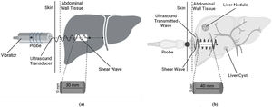 (a): Illustration of the FibroScan® Measurement Technique, (b): Illustration of the FibroTouch® Measurement Technique.