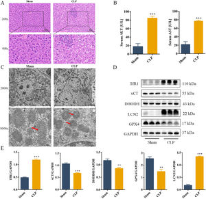 CLP induces liver damage in mouse by activating ferroptosis in the liver tissue.