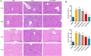 Ferroptosis inhibition alleviates liver damage caused by sepsis.