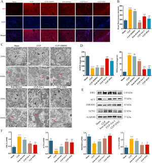 Inhibition of ferroptosis regulates sepsis-induced liver injury by reducing lipid peroxidation and iron overload.