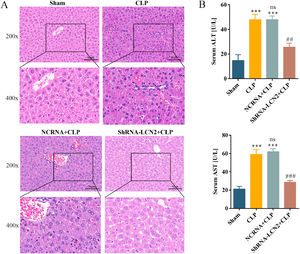 LCN2 knockdown attenuates liver damage caused by sepsis.