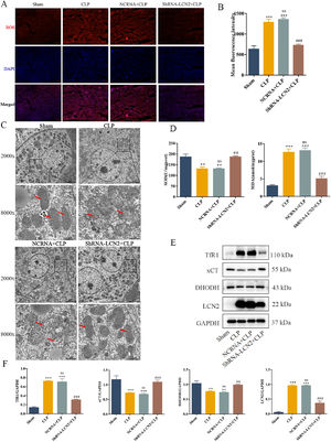 LCN2 knockdown protects mice against sepsis by inhibiting lipid peroxidation and ferroptosis.