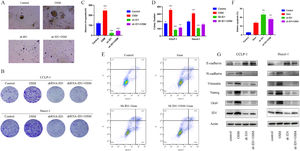 Biological effect of OSM on CCA and the related mechanism. (A-B) Representative bright-field images and diameters of CCA organoids in the four groups. Scale bars: 100 μM. The data are shown as the means±SD (n = 5 for each group). ***p < 0.001. (C-D) A colony formation assay and subsequent crystal violet staining were performed to determine colony numbers. The data are shown as the means±SD (n = 3 for each group). **p < 0.01, ***p < 0.001. (E-F) CCA cells were incubated under different conditions as indicated in the presence or absence of 5 μM Gem for 48 h, and the percentage of apoptotic cells was analyzed via FACS. The data are shown as the mean ± SD of three independent experiments. (G) Western blot analysis of EMT-related genes (E-cadherin, N-cadherin and vimentin), stem cell markers (Nanog and Oct-4), and ID 1 in CCA.