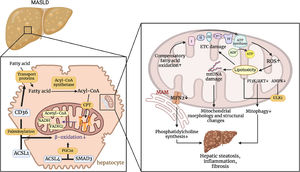 Pathophysiological mechanisms by which Mitochondrial Dysfunction Affects MASLD. CD36 regulates transport proteins that transport fatty acids into cells. CD36 can promote the transport of long-chain fatty acids into the cell via transport proteins, and palmitoylated CD36 interacts with ACSL1 to inhibit β-oxidation. ACSL4 can also regulate PGC1α in a smad3-dependent manner to affect β-oxidation. These processes result in the accumulation of fatty acids within the hepatocyte. Impaired ETC and increased ROS production lead to lipotoxicity, which in turn damages mtDNA and exacerbates changes in mitochondrial structure and function. The accumulation of lipotoxicity and the inhibition of the PI3K/AKT and AMPK pathways impair mitochondrial autophagy. In addition, decreased MFN2 expression in MAMs leads to reduced phosphatidylcholine synthesis. This series of events ultimately promotes hepatic steatosis, inflammation, and fibrosis. (Created with BioRender.com)