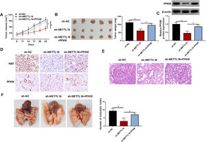 Restored PFKM expression abolishes METTL16 deficiency-driven tumor growth suppression in vivo. Sh-NC- or sh-METTL16 lentivirus-infected MHCC97 cells were implanted subcutaneously or intravenously into nude mice, with or without administration of the PFKM expression lentivirus. n = 8 for each group. Five mice were used for xenograft collection at day 23, and three mice were used for lung collection at week 6. (A) Growth curves of MHCC97 xenografts. (B) Images and mean weight of MHCC97 xenografts on day 23. (C) Expression of PFKM protein by immunoblotting in MHCC97 xenografts. (D) Expression of PFKM and Ki67 by immunohistochemistry in MHCC97 xenografts. (E) H&E staining of lung tissues of xenograft mice. (F) The number of metastasis nodes in lung tissues of xenograft mice. *P < 0.05 based on one-way ANOVA followed by Tukey-Kramer post hoc test.