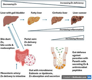 The different stages of liver disease and the gut-liver axis, including the microbiome. The extent of zinc deficiency increases with progression of liver disease. The gut is the main organ for zinc absorption and secretion. From the gut zinc is transferred to the liver via the portal vein, distributed to other organs, but also a surplus returned to the gut via the bile and the mesenteric artery in the enterohepatic circulation. The microbiome has a major role in determining the integrity of the gut barrier and the uptake of zinc.
