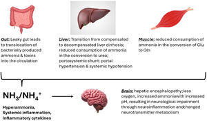 Hepatic encephalopathy. Liver cirrhosis can lead to portosystemic shunt. A leaky gut, lack of metabolism of ammonia to urea in the liver, and reduced consumption of ammonia in muscle cause hyperammonemia, which together with systemic inflammation leads to neurological impairments. Zinc participates at several junctures as discussed in the main text. (Liver: Creator: eranicle | Credit: Getty Images. Copyright: eranicle; Brain: Creator: 3dMediSphere | Credit: Getty Images; intestine: Azat Valeev, Vecteezy, no attribution required. Copyright: Eraxion; for muscle: Vecteezy | License details Creator: Julee Ashmead | Credit: Vecteezy) Copyright: Julee Ashmead.