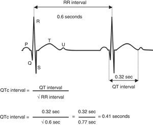 Calculation of the corrected QT interval.