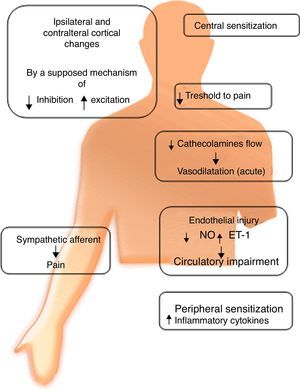 Clinical manifestations of CRPS and pathophysiological mechanisms proposed to each.
