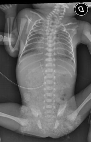 Thoracoabdominal X-ray.