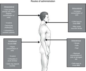 Possible routes of administration of stem cells for stroke.