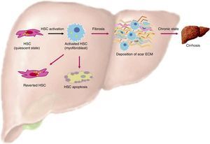 Activation of HSC. This is a general view of HSC activation, transforming them into myofibroblast phenotypes, increasing production of ECM in the liver and stress in liver tissue. On the other hand, another ending for HSC is apoptosis, where overproduction of ECM by these cells is finished. Finally, HSCs can actually revert from their myofibroblast phenotypes into a quiescent state, but these can easily change into a myofibroblast phenotype again.