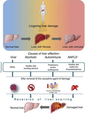 Evolution of liver resolution. This figure explains the evolution of liver damage and its consequences by different etiologies; the therapy that must be applied to the patient in order to resolve and restore metabolic liver function depends on the agent of damage.