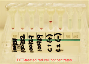 Antibody screening panel erythrocytes DTT threated, showing negative results in 4 blood donors. C1 (control positive) C2 (control negative).