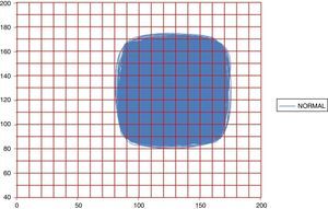 Attractor of a normal dynamic in 16h with the Kg grid superimposed, with spaces of occupation of Kp=349 and Kg=97 (No. 29 of Table 1).