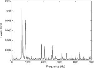 Normal vibration signal by FFT.
