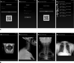 The mobile service system for standard DICOM image viewer. A: application screens; from left to right: login screen, update password screen, search patient screen and medical images of a patient. B: the corresponding DICOM images of a patient.